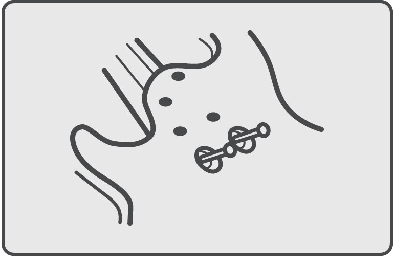 마이터 볼팅(Miter Bolting)